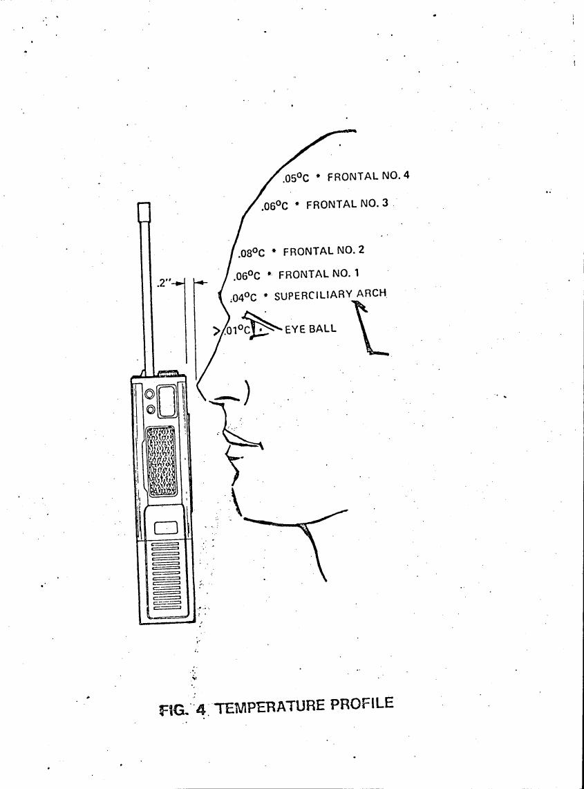 AI-described figure: Figure 4: Temperature profile showing temperature variations across different facial regions.