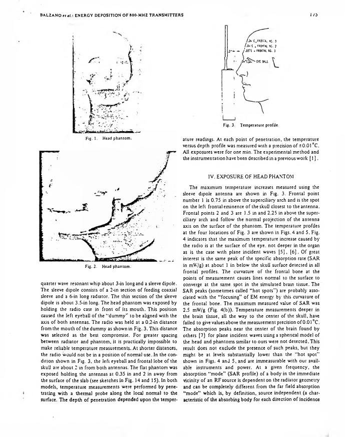 AI-described figure: Figure 1 and Figure 2 show head phantoms used in an exposure study.