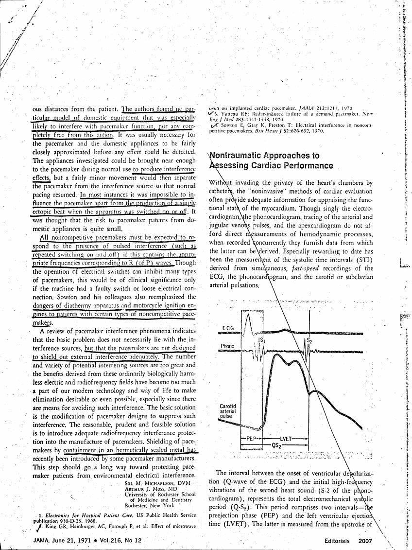 AI-described figure: A diagram illustrating cardiac performance metrics such as ECG, phonocardiogram, and carotid arterial pulse waveforms with labeled intervals like PEP (pre-ejection period) and LVET (left ventricular ejection time).