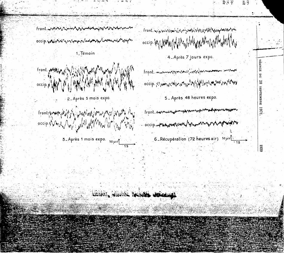 AI-described figure: Electroencephalogram (EEG) recordings showing changes over time after exposure and recovery periods.