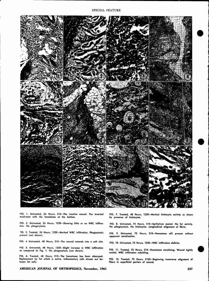 AI-described figure: A series of microscopic images showing wound healing at various stages and treatments over time.