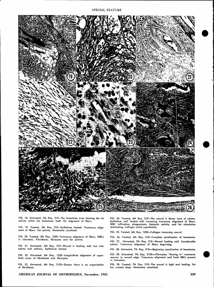 AI-described figure: Microscopic images showing various stages and conditions of tissue healing in treated and untreated samples over different days.