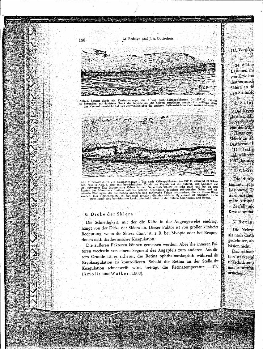AI-described figure: Microscopic cross-sections (Abb. 3 and Abb. 6) showing tissue damage in a canine eye after cryotherapy application, highlighting changes in the sclera, choroid, and retina.