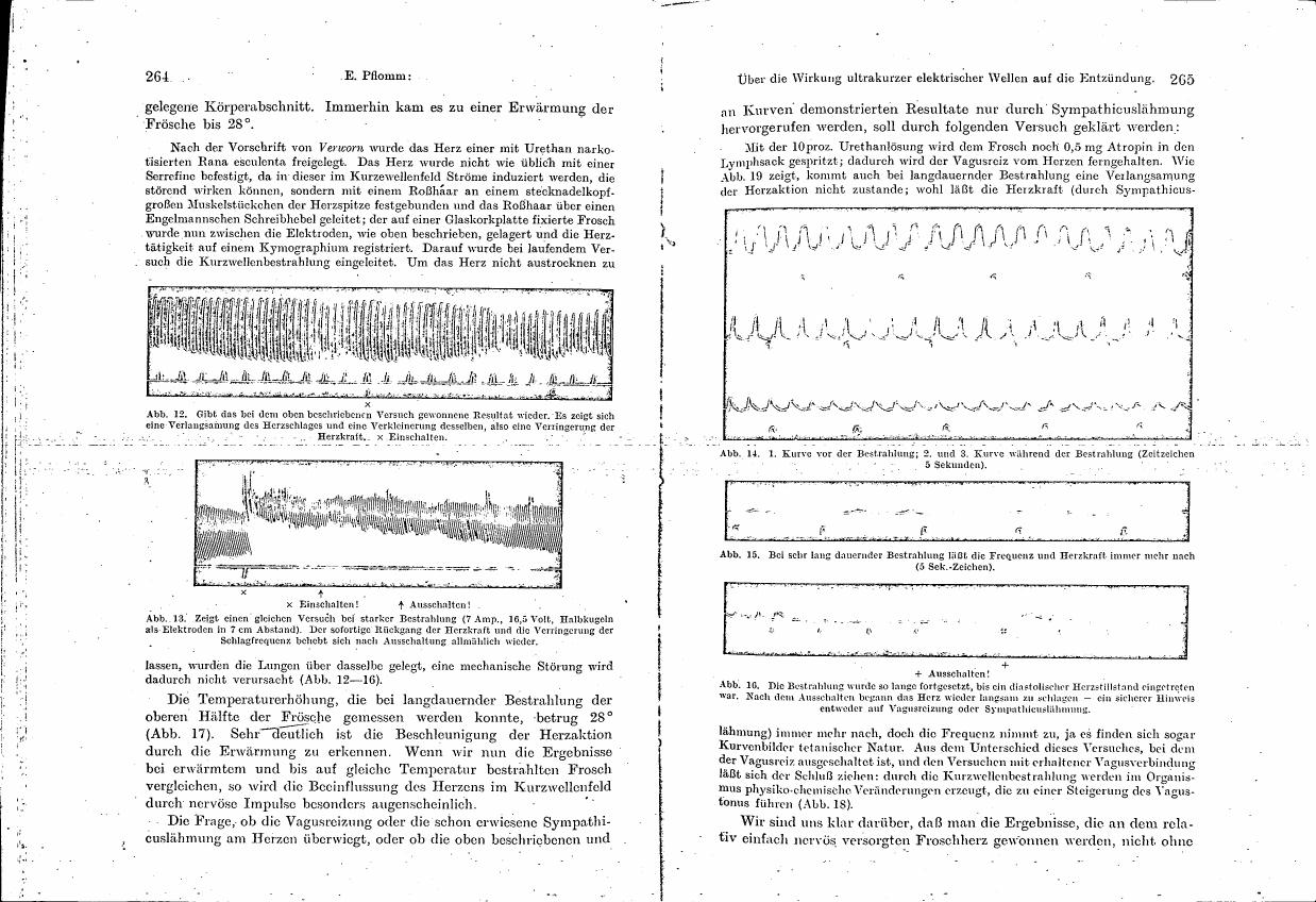 AI-described figure: Electrocardiogram (ECG) traces showing heart rate changes before and during exposure to ultrashort electromagnetic waves. (Figures 12, 14-16)