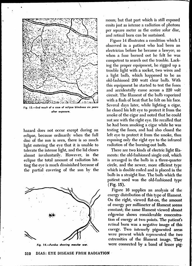 Figure 13 illustrates the end result of a case of eclipse blindness six years after exposure.