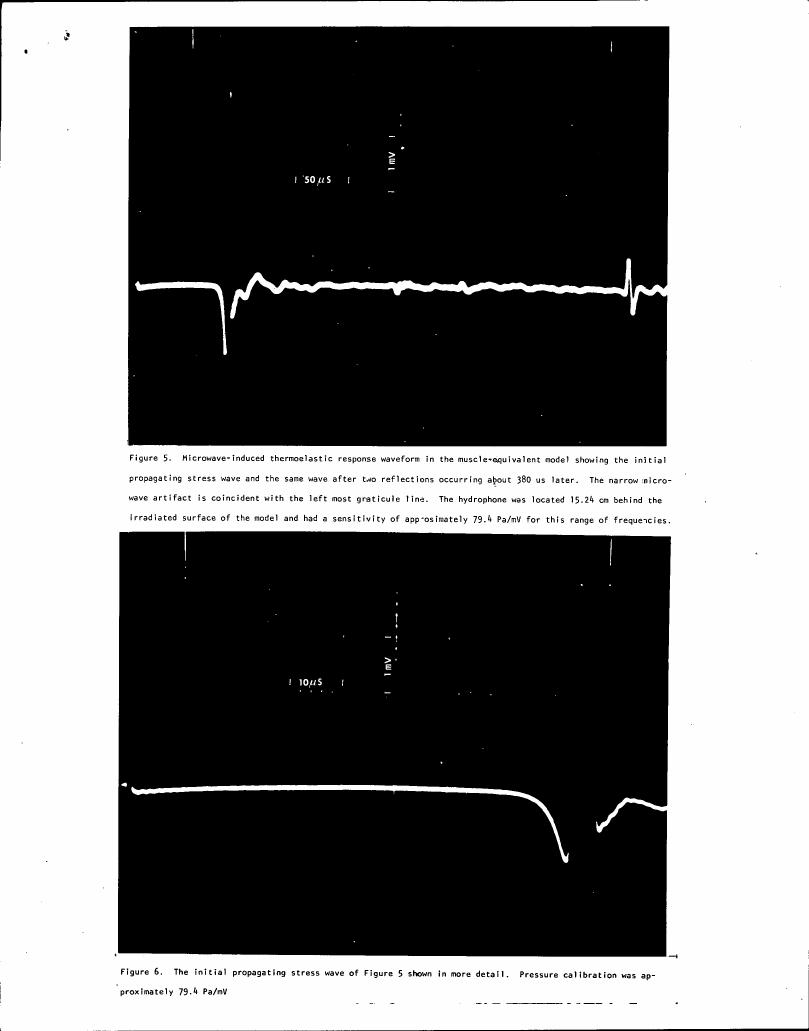 Figure 5. Microwave-induced thermoelastic response waveform in the muscle-equivalent model showing the initial propagating stress wave and the same wave after two reflections occurring about 380 us later.