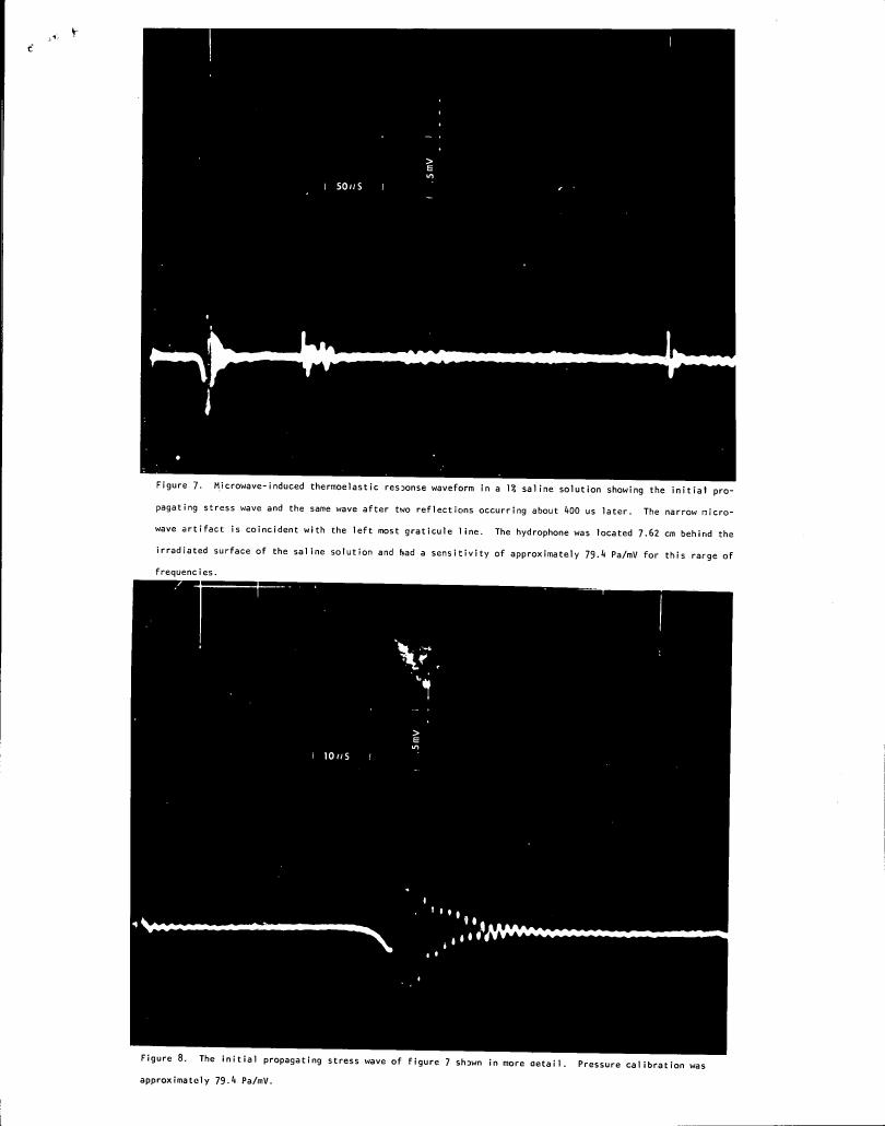 Figure 7. Microwave-induced thermoelastic response waveform in a 1% saline solution showing the initial propagating stress wave and the same wave after two reflections occurring about 400 us later.
