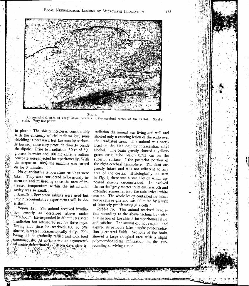 Fig. 1: Circumscribed area of coagulation necrosis in the cerebral cortex of the rabbit.