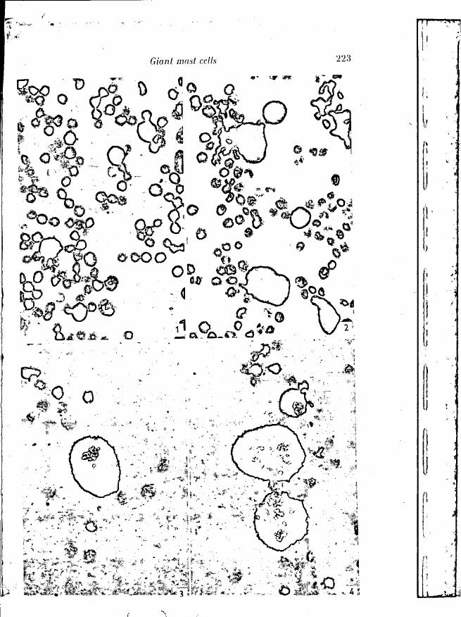 AI-described figure: The diagram illustrates 'Giant mast cells' with various shapes and sizes depicted in a microscopic view.