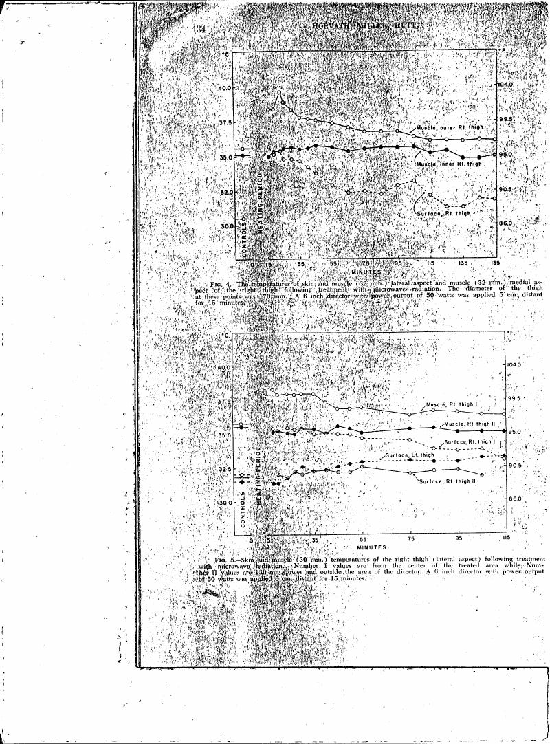 Figures showing temperatures of skin and muscle on the right thigh following microwave radiation treatment.