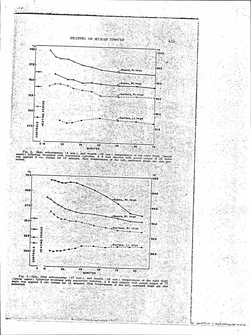 AI-described figure: Figures showing skin, subcutaneous, and muscle temperatures over time following microwave radiation treatment on human thighs.