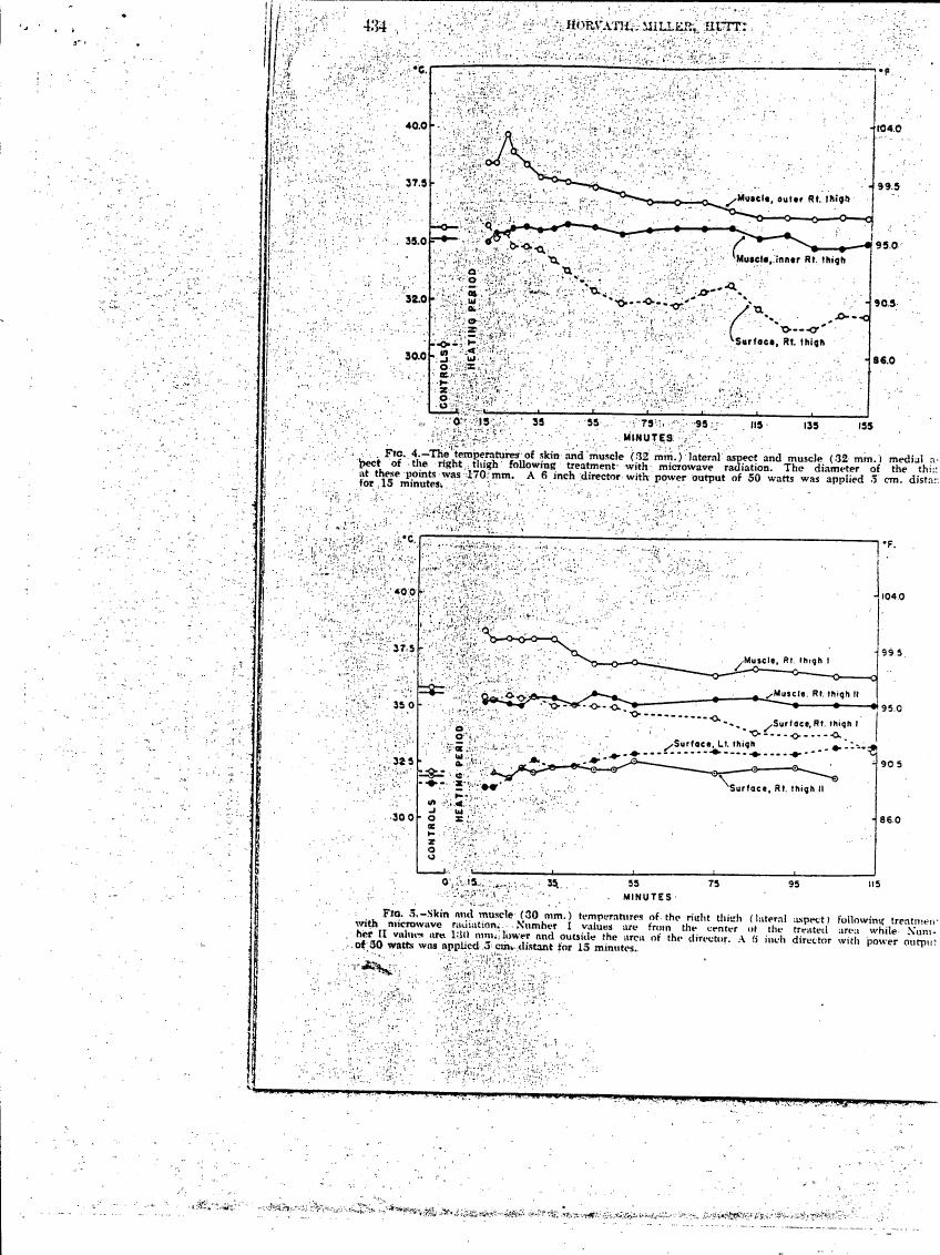 AI-described figure: Figures showing temperature changes in skin and muscle following microwave radiation treatment on the right thigh.