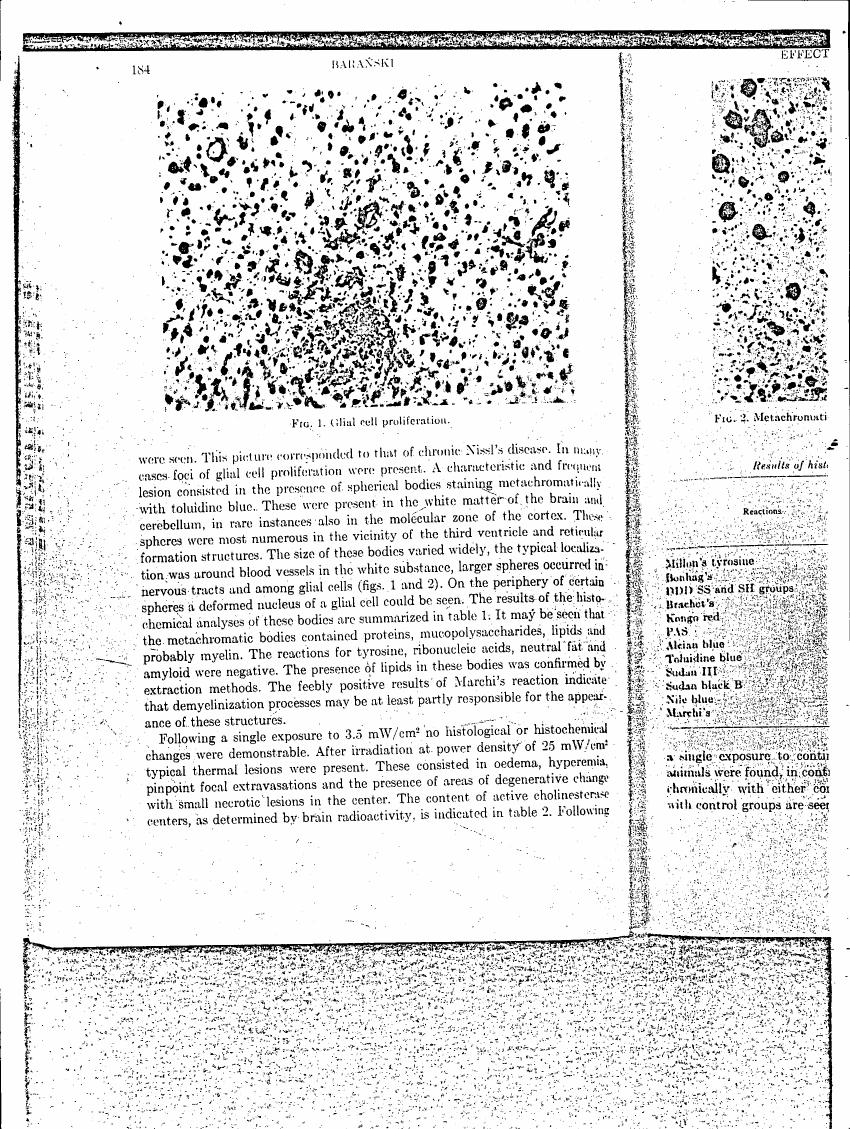 AI-described figure: Fig. 1: Glial cell proliferation; Fig. 2: Metachromatism