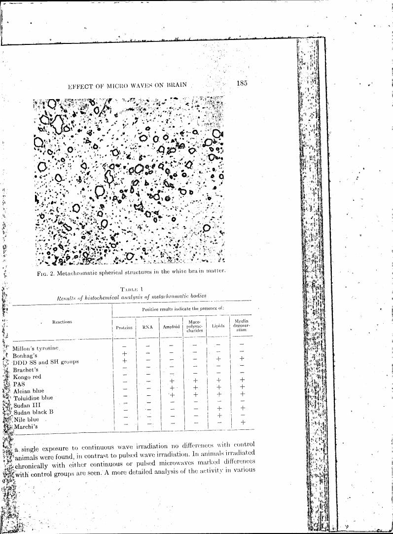 Fig. 2: Metachromatic spherical structures in the white brain matter.