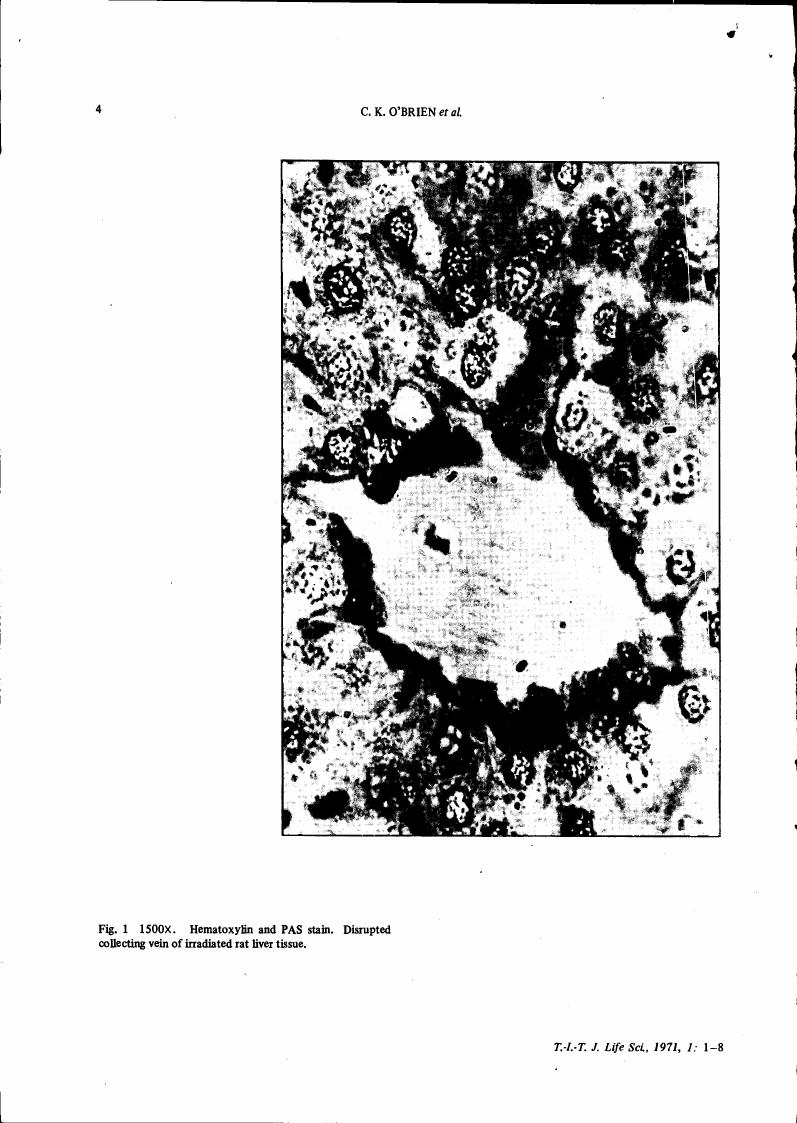 AI-described figure: Fig. 1: A high-magnification (1500x) image showing disrupted collecting veins in irradiated rat liver tissue stained with hematoxylin and PAS.