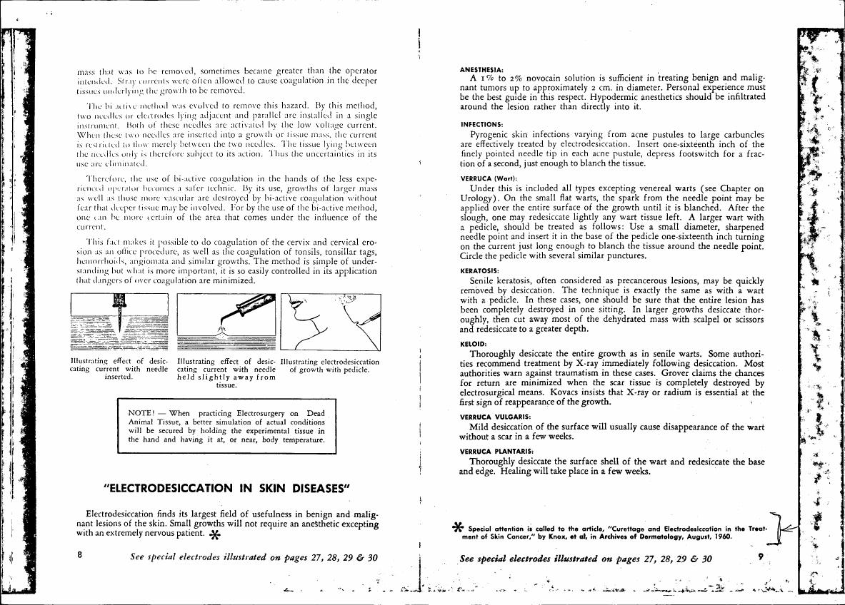 AI-described figure: Illustrations demonstrating the effect of desiccating current with a needle inserted and held slightly away from tissue.