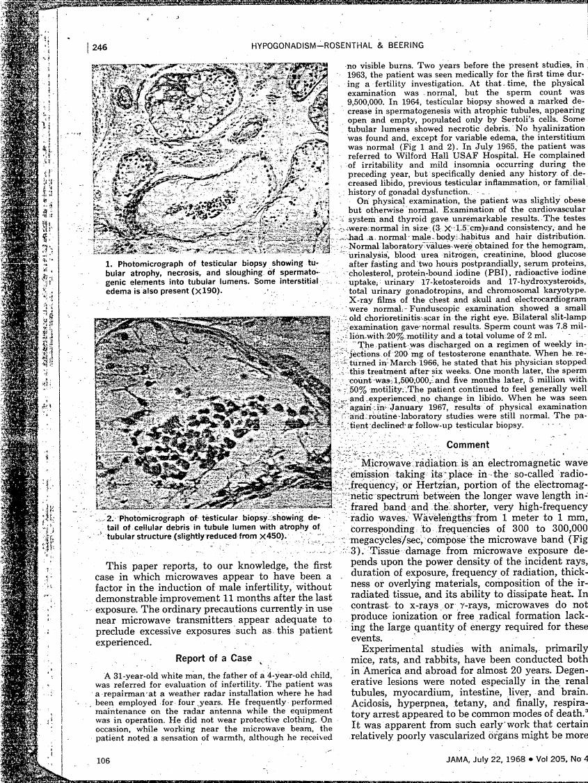 AI-described figure: Photomicrographs of testicular biopsy showing tubular atrophy and cellular debris in tubule lumens.