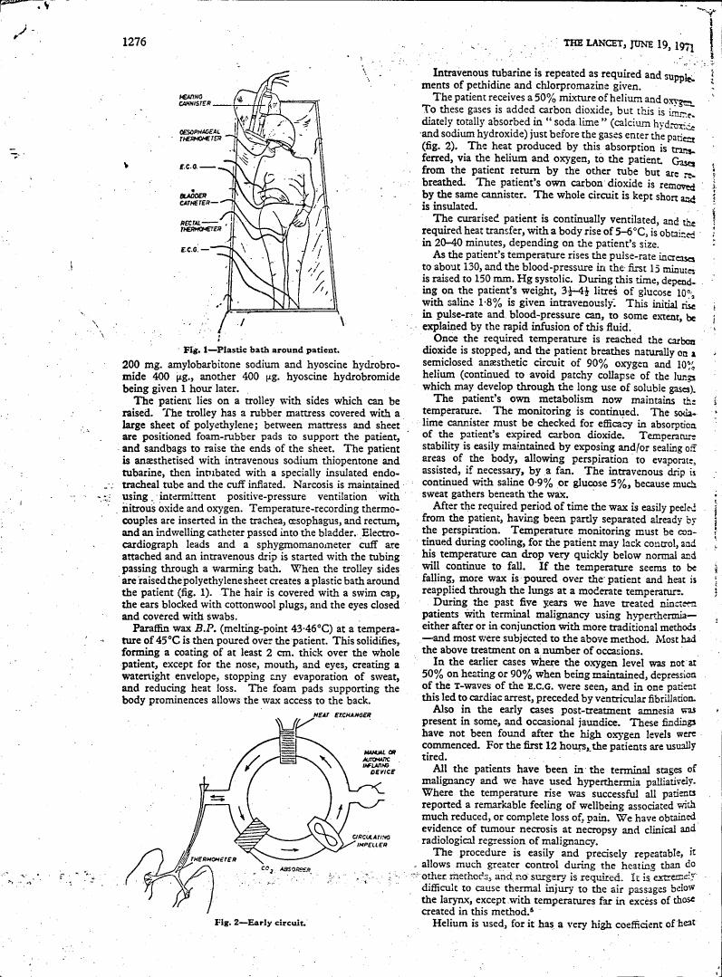 AI-described figure: Figure 1 illustrates a plastic bath around a patient for hyperthermia treatment.