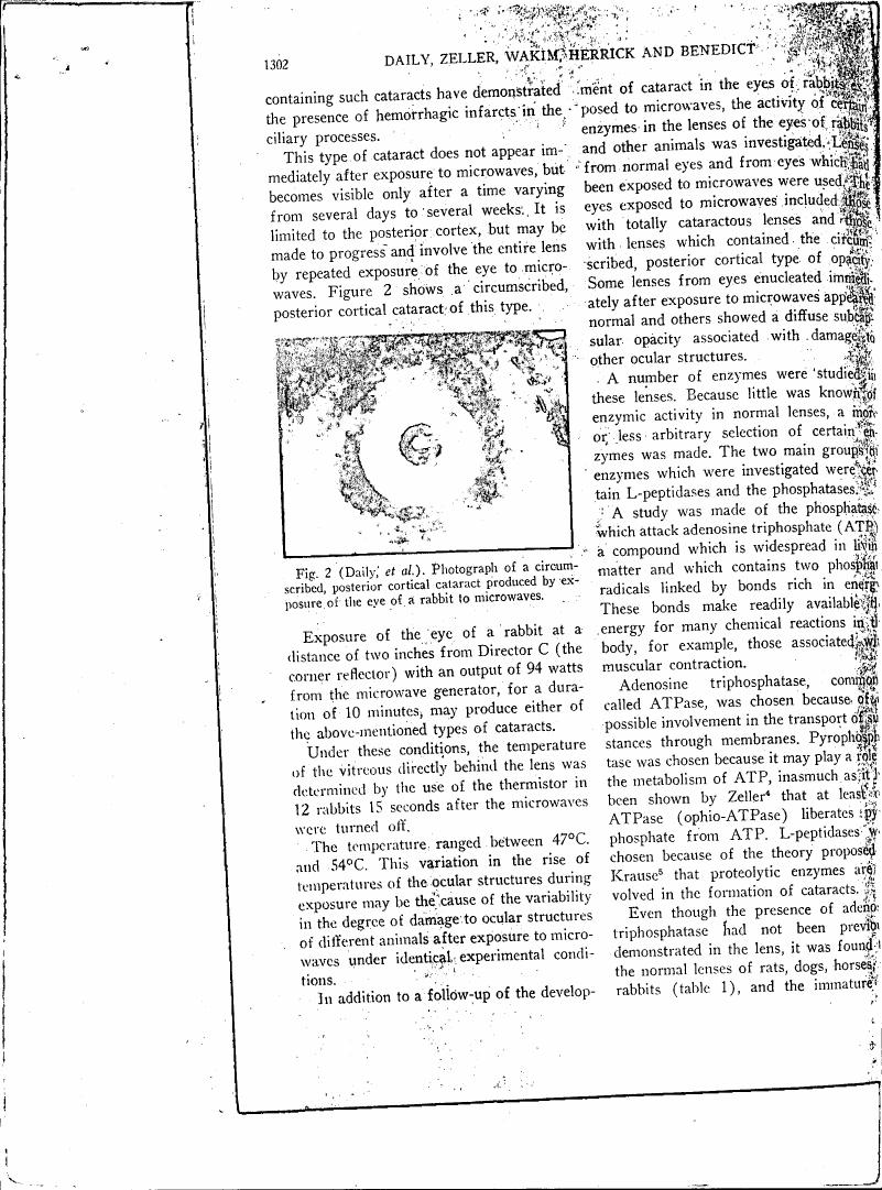 Photograph of a circumscribed posterior cortical cataract produced by exposure of the eye of a rabbit to microwaves.