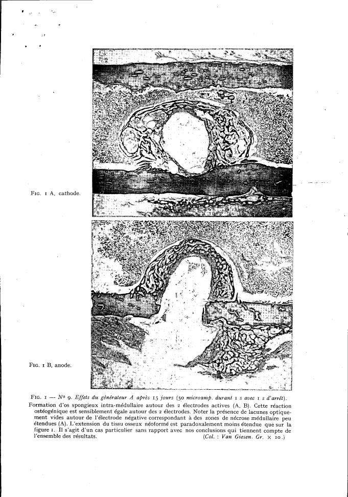 AI-described figure: Fig. 1A and Fig. 1B show cross-sectional views of tissue around electrodes after 15 days of treatment with a generator, highlighting the formation of spongy bone and osteogenic reaction.