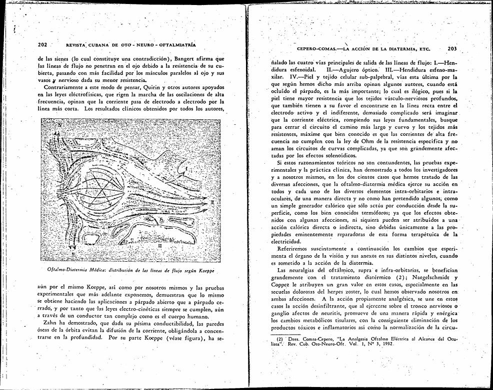 Oftalmó-Diatermia Médica: distribución de las líneas de flujo según Koepp