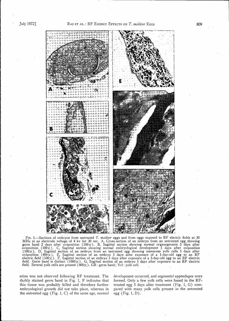 AI-described figure: Fig. 1 displays sections of embryos from untreated and RF-exposed T. molitor eggs at various stages of development.
