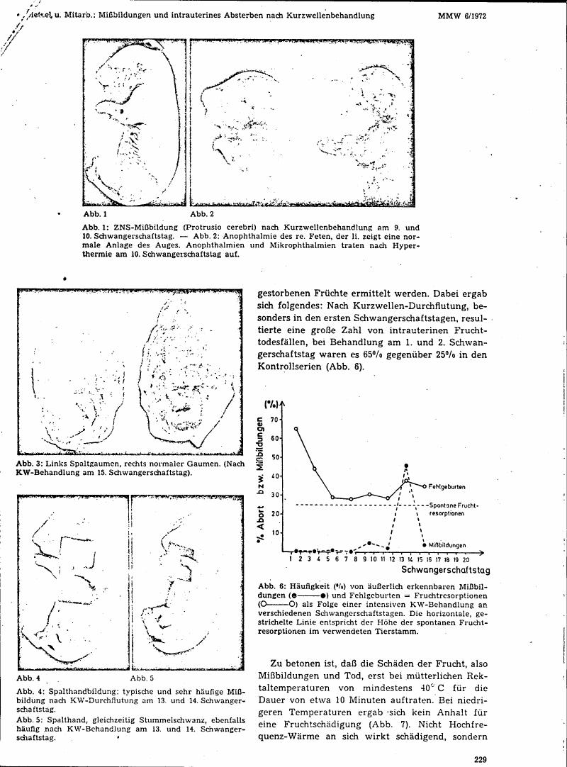 AI-described figure: Frequency (%) of externally recognizable malformations and spontaneous abortions as a result of intense KW treatment on different days of pregnancy.