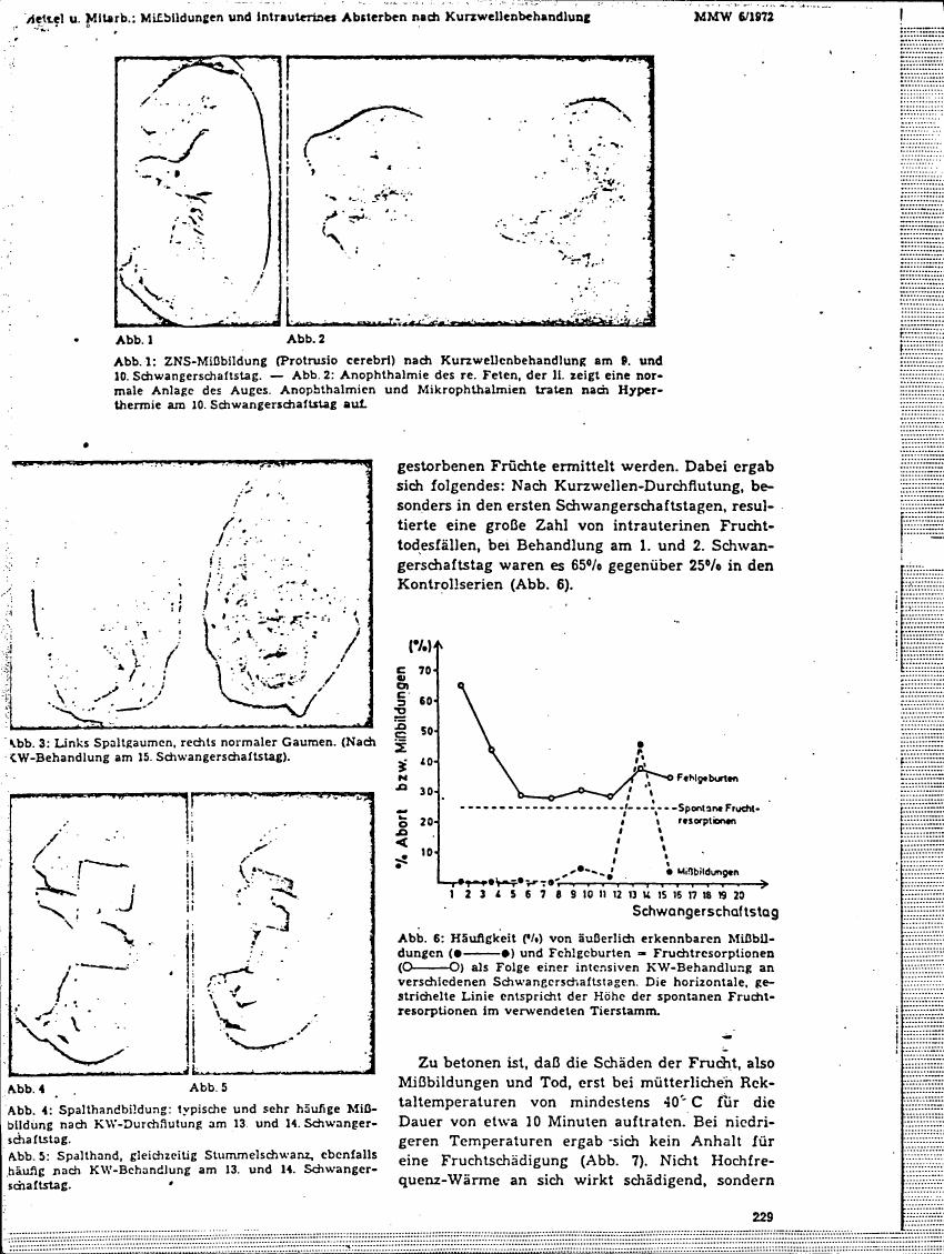 AI-described figure: Figure 6 illustrates the frequency (%) of externally recognizable malformations and spontaneous abortions as a result of intense KW treatment on different days of pregnancy, comparing to the spontaneous abortion rate in control series.