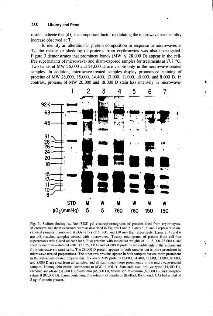 Figure 3. Sodium dodecyl sulfate (SDS) gel electrophoretograms of proteins shed from erythrocytes.