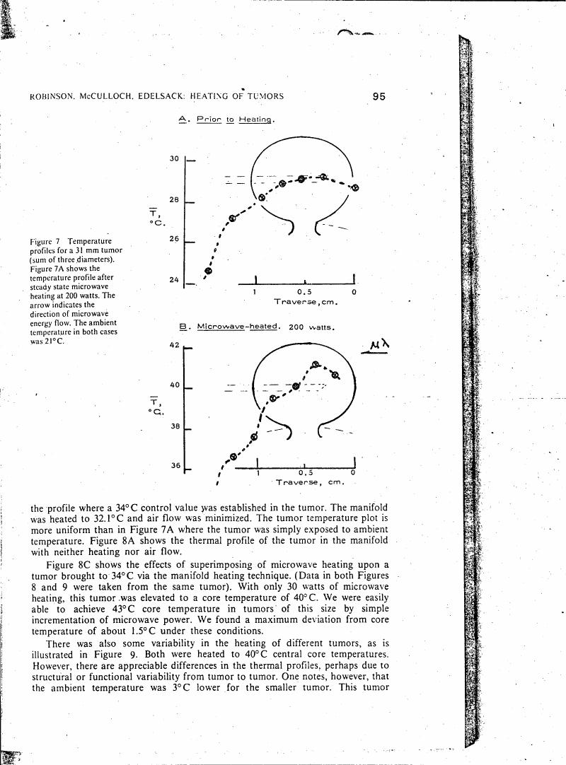 AI-described figure: Temperature profiles for a 31 mm tumor (sum of three diameters) before and after microwave heating at 200 watts.