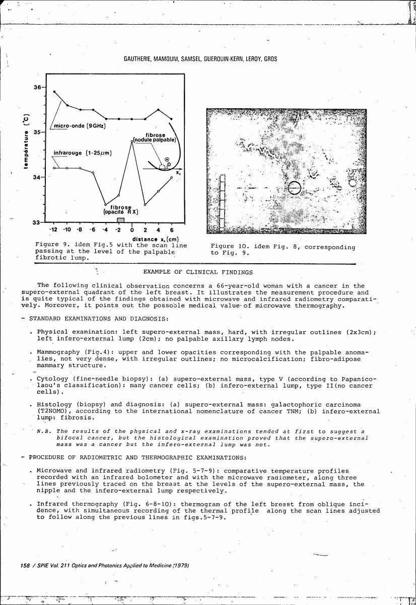 AI-described figure: Figure 9. A graph showing temperature (°C) versus distance x (cm), with data points for microwave and infrared measurements at different wavelengths.