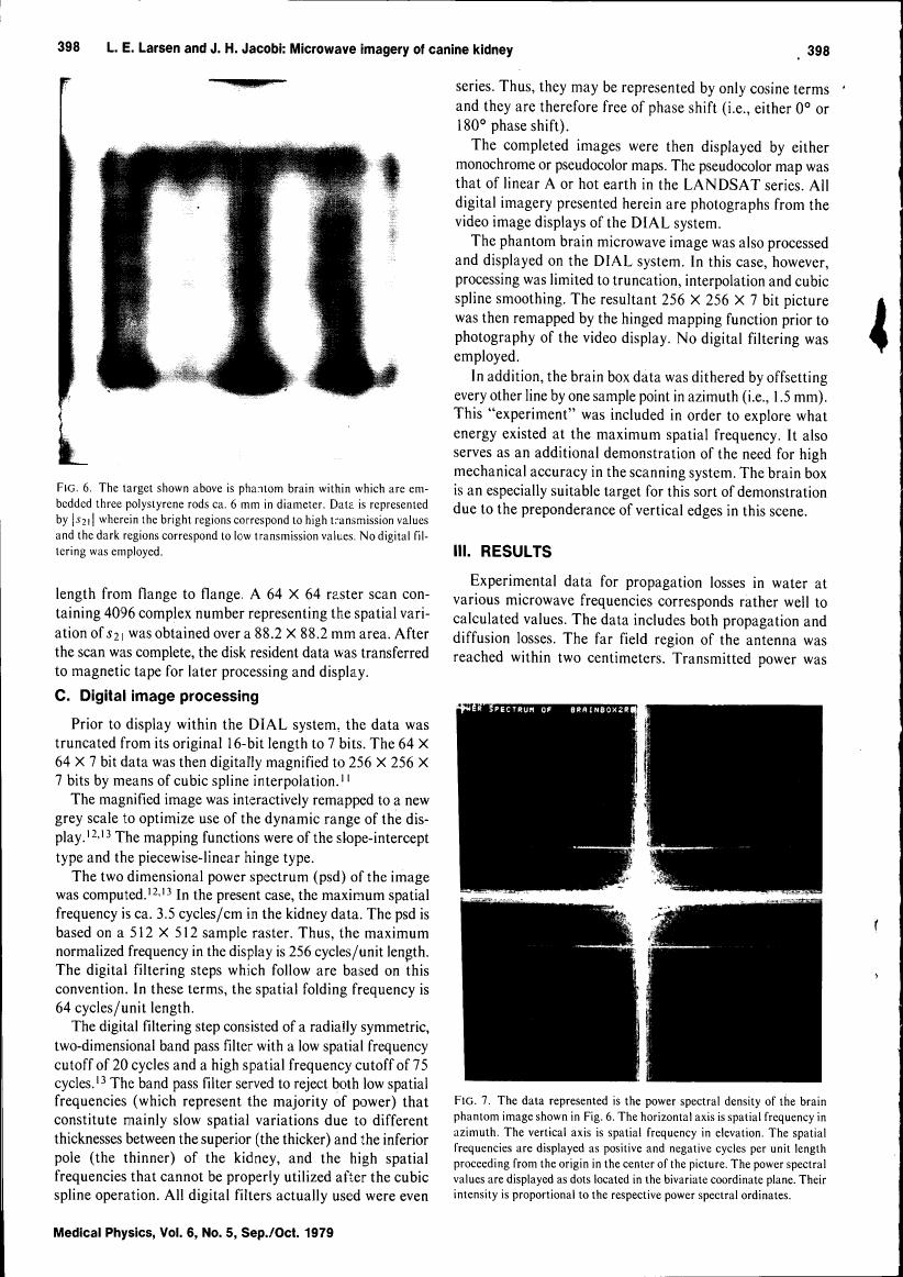 AI-described figure: Figure 7 displays the power spectral density of a brain phantom image, with axes representing spatial frequency in azimuth and elevation.