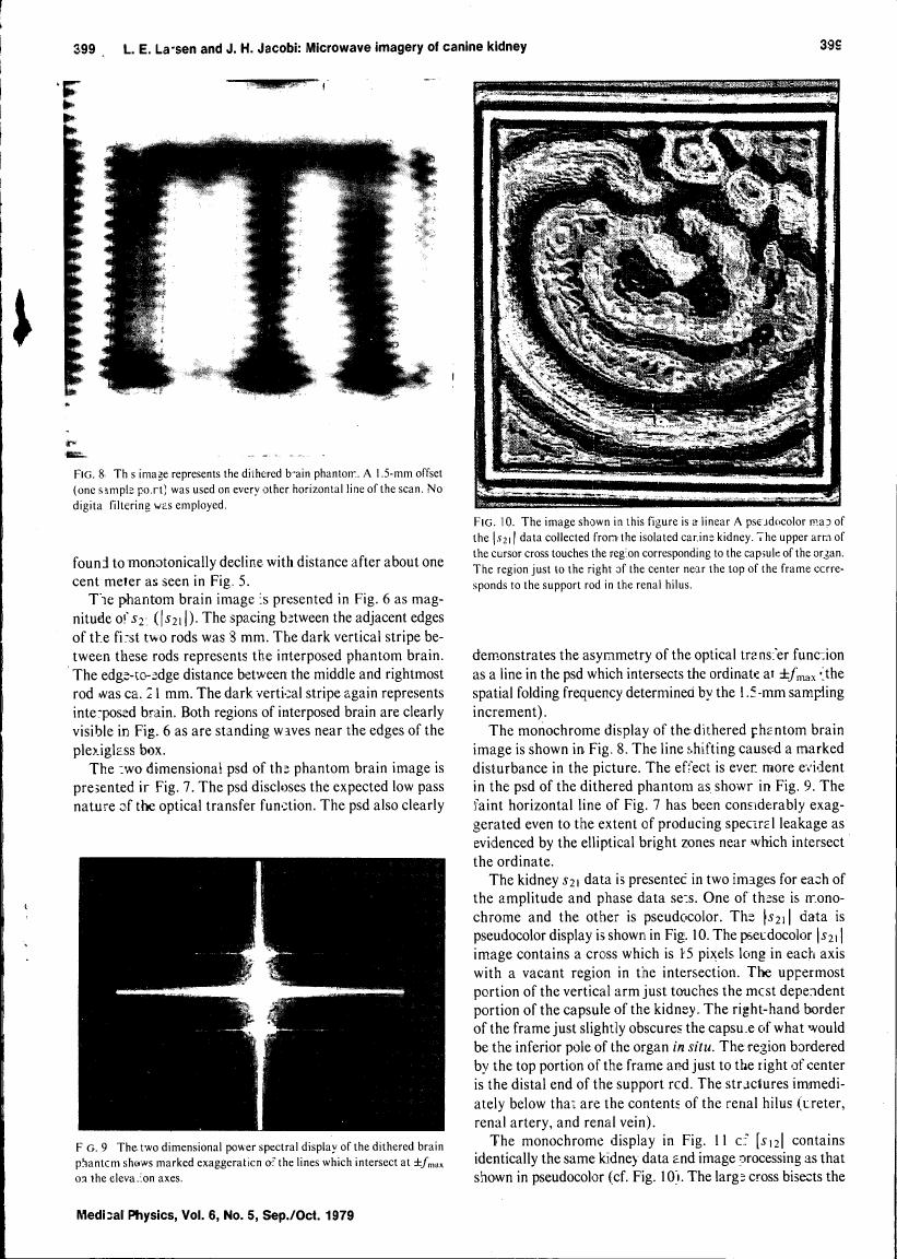 AI-described figure: Figure 8 illustrates a dithered brain phantom image with a 1.5-mm offset applied to every other horizontal line, demonstrating the effect of this offset on the image.