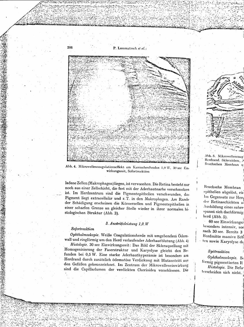 AI-described figure: Figure 4 illustrates a microwave coagulation effect on the rabbit fundus at 1.0 W with a 30-second exposure time, showing immediate reaction.