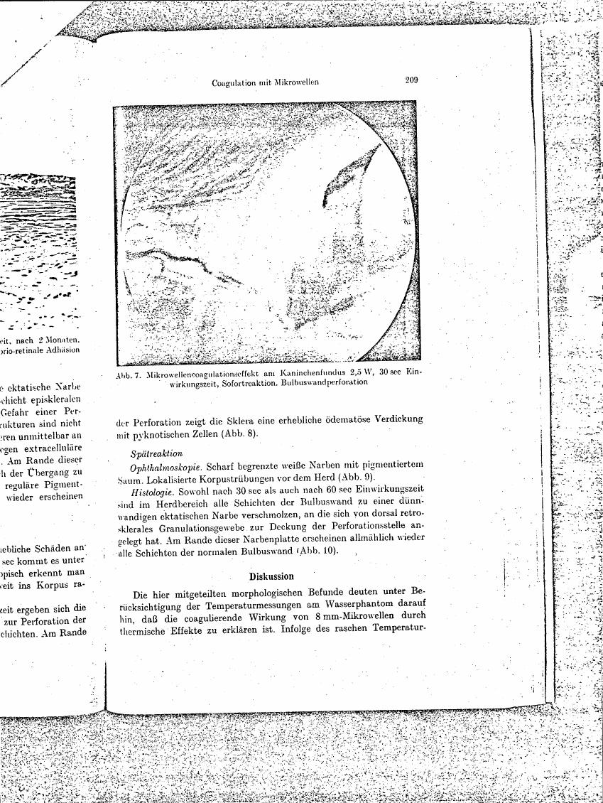 Figure 7 illustrates a microwave coagulation effect on rabbit fundus at 2.5 W for 30 seconds, showing immediate reaction and bulbus wall perforation.