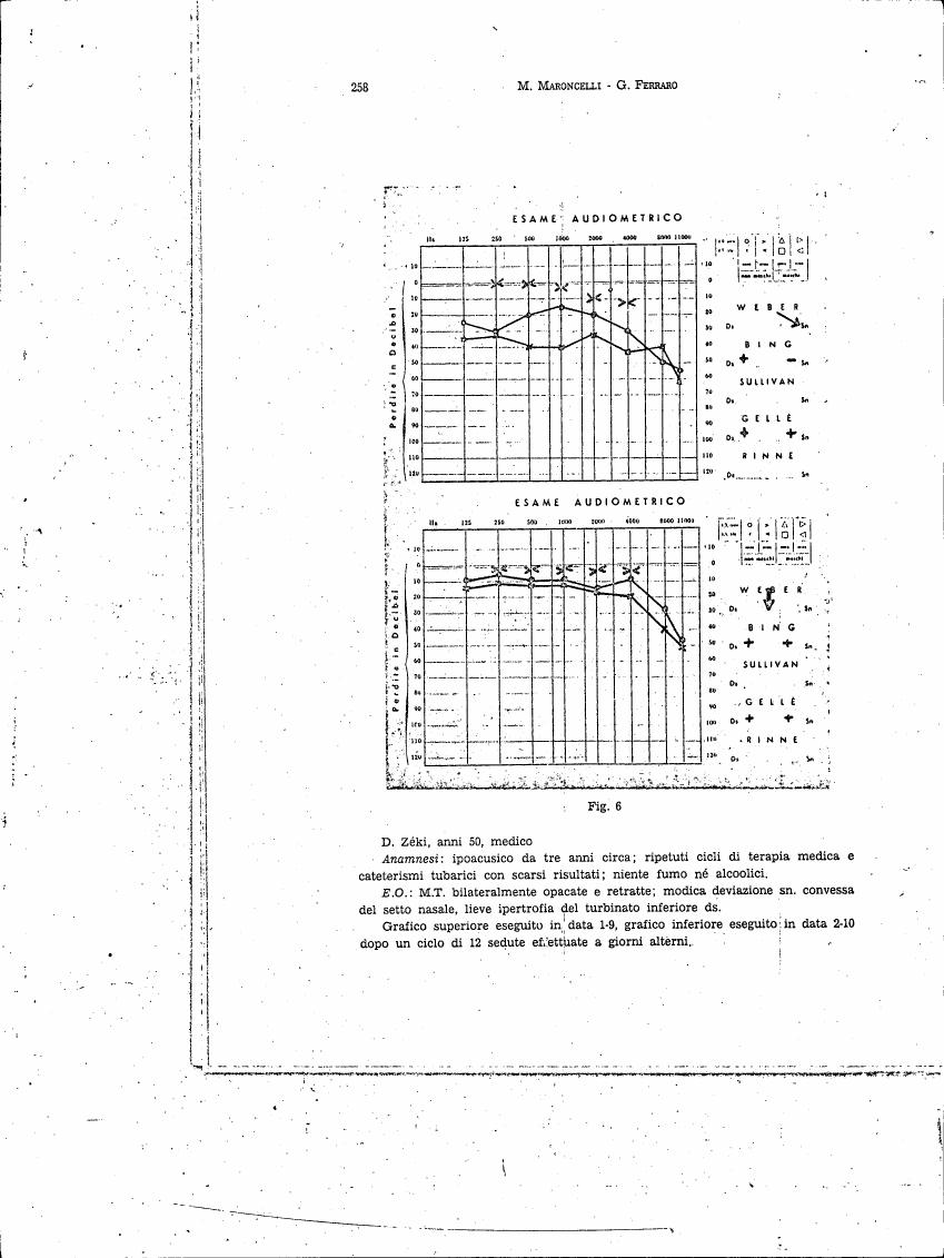 AI-described figure: Figure 6: Audiometric test results for a medical patient with symptoms related to nasal and sinus conditions.