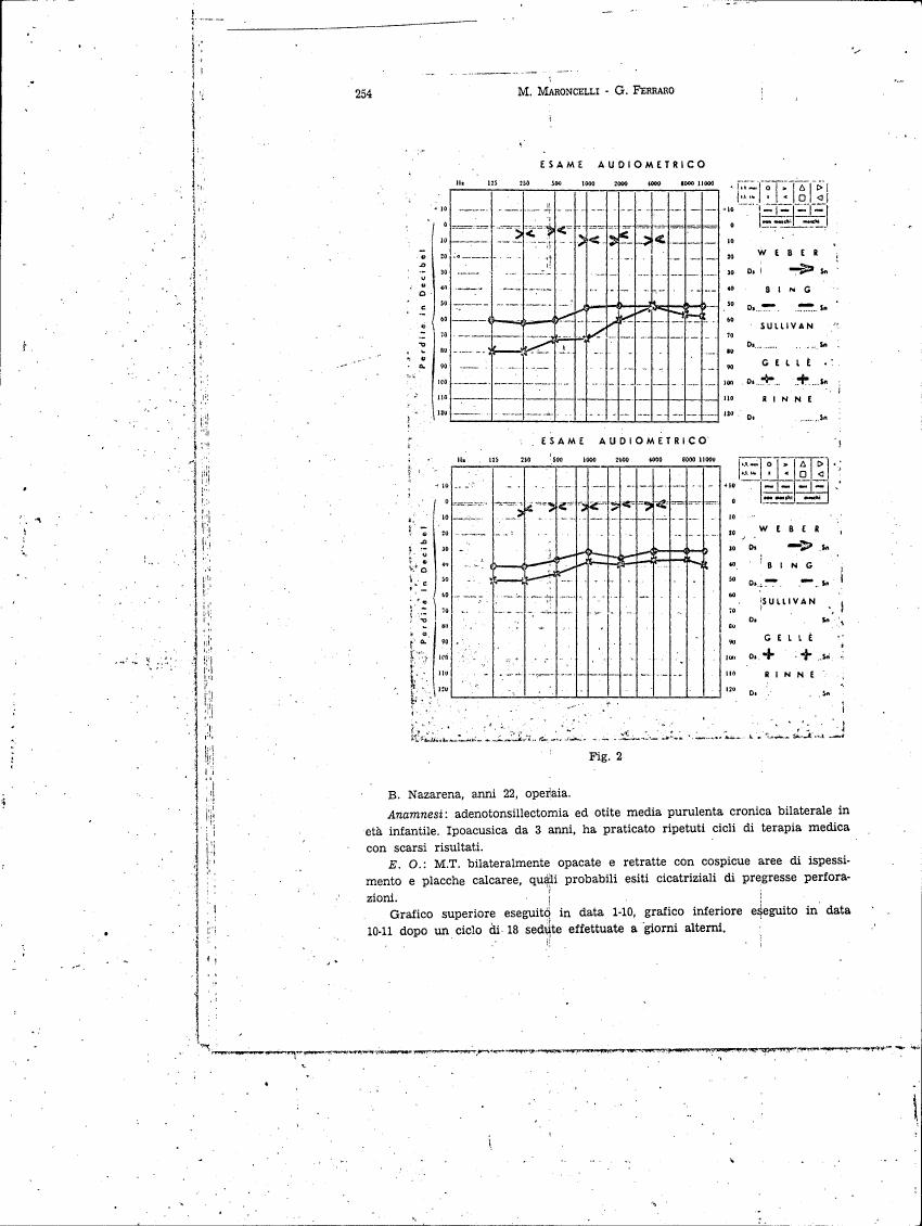 AI-described figure: Audiometric test results for B. Nazarena, showing hearing loss in decibels across different frequencies.