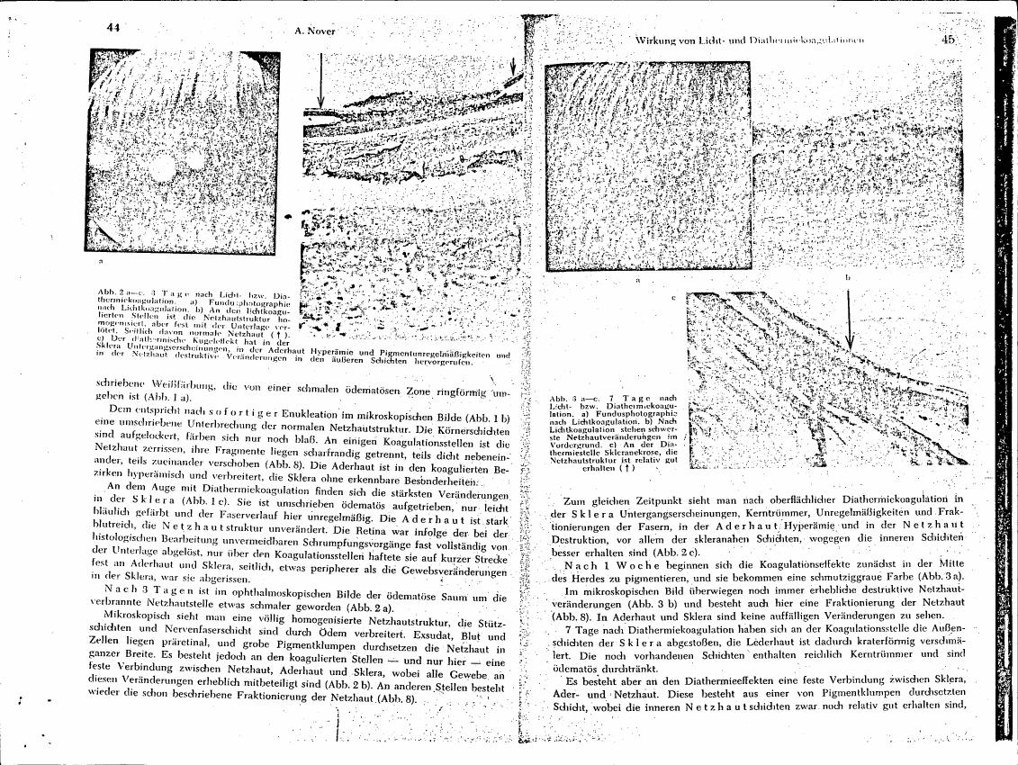 AI-described figure: Microscopic images showing changes in retinal structure after light or diathermic coagulation at different time points (e.g., 3 days and 7 days).