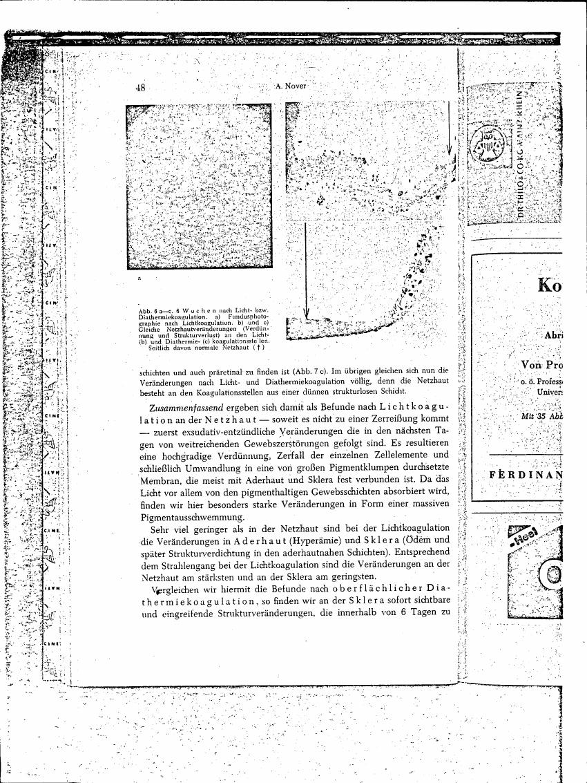 AI-described figure: A diagram showing fundus photographs and histological sections (Figures 8a-c) comparing changes in retinal tissue after light- and diathermy coagulation.