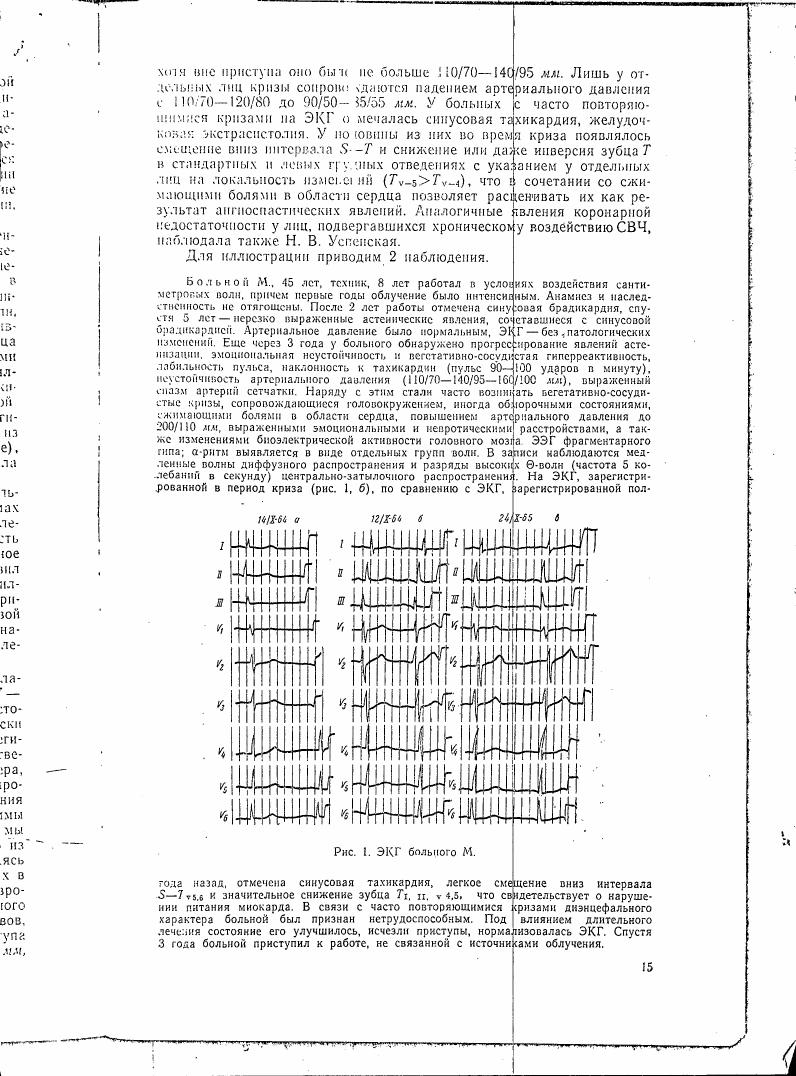 AI-described figure: Electrocardiogram (ECG) recordings from patient M over different time points.