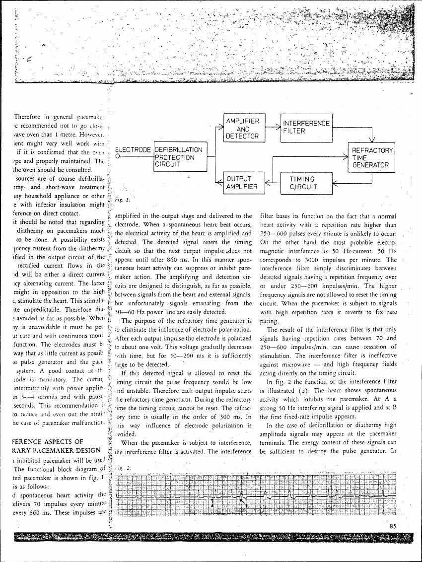 AI-described figure: A functional block diagram illustrating the components and flow in a pacemaker system, including an amplifier and detector, interference filter, refractory time generator, timing circuit, and output amplifier.