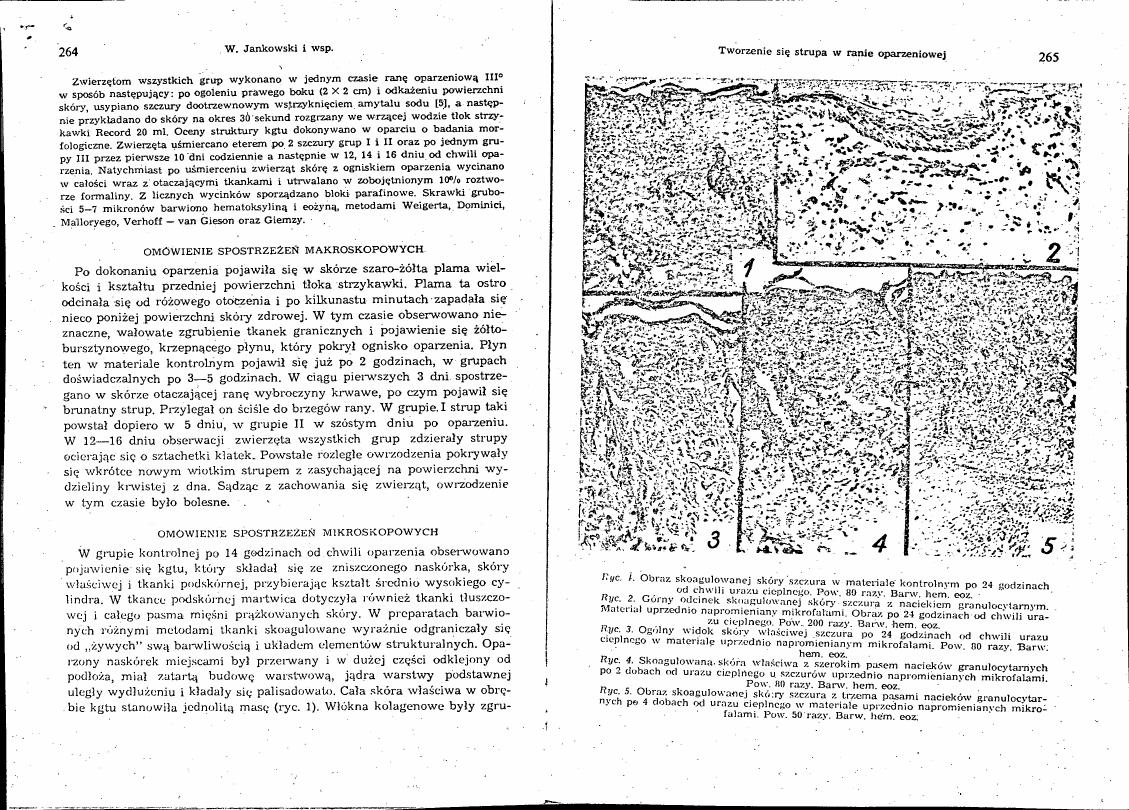 AI-described figure: Figure 1: Microscopic image showing the organization and structure of scabulated skin in control material after 24 hours from thermal injury.