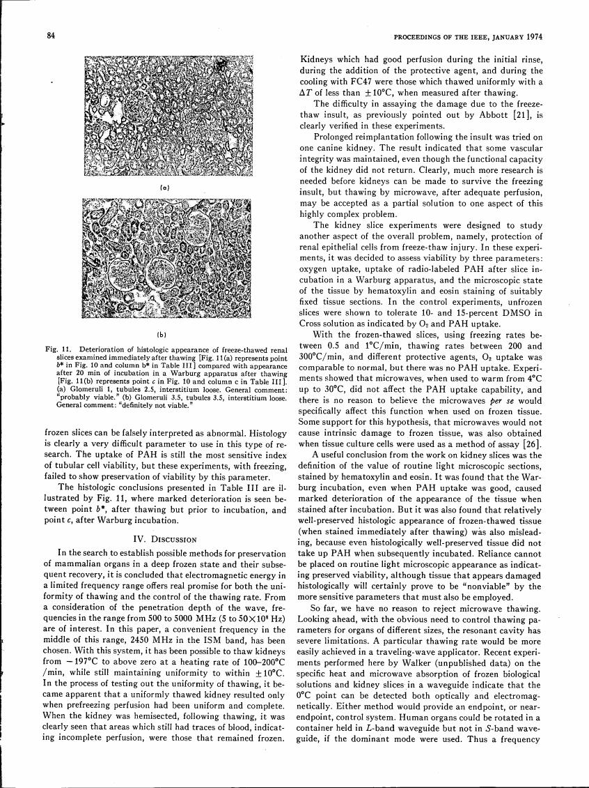 Fig. 11 illustrates the deterioration in histologic appearance of freeze-thawed renal slices examined immediately after thawing.