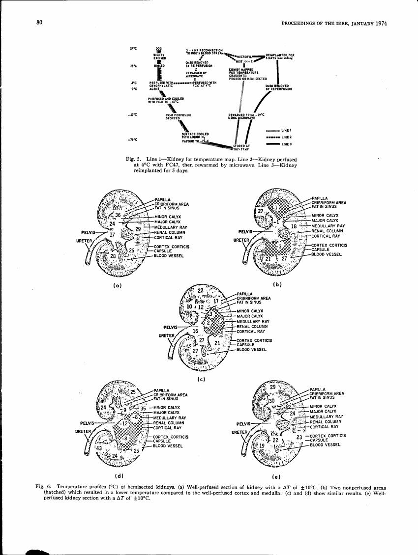 AI-described figure: Figure 5 illustrates a temperature map and reimplantation process for kidneys at various temperatures.