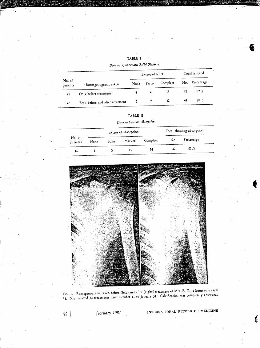 AI-described figure: Figure 1 displays Roentgenograms taken before and after treatment for Mrs. E.Y., a housewife aged 35, showing the absorption of calcification.