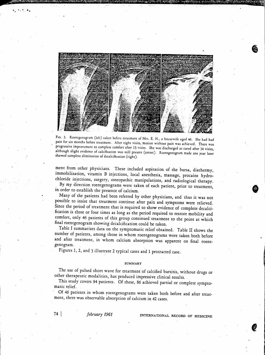 Figure 3. Roentgenogram (left) taken before treatment of Mrs. E. H., a housewife aged 46.