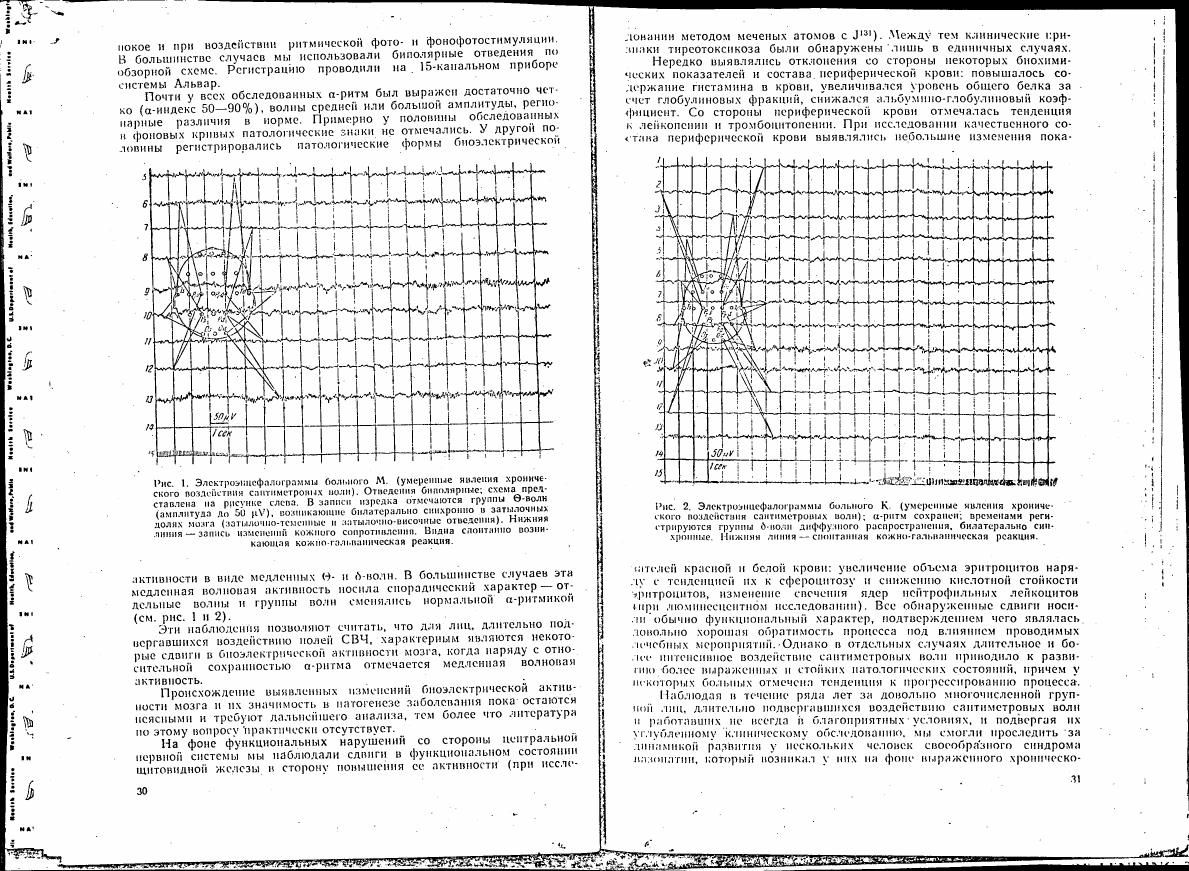 AI-described figure: Electroencephalograms showing waveforms and their amplitude in response to certain stimuli (Figure 1)