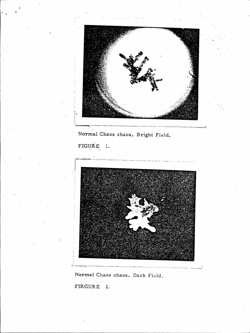 AI-described figure: Figure 1 and Figure 2 show 'Normal Chaos chaos' under bright field and dark field microscopy respectively.