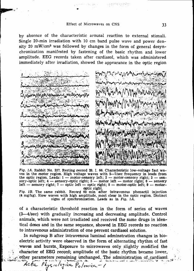 AI-described figure: EEG recordings from a rabbit showing changes in brainwave activity before and after microwave irradiation.