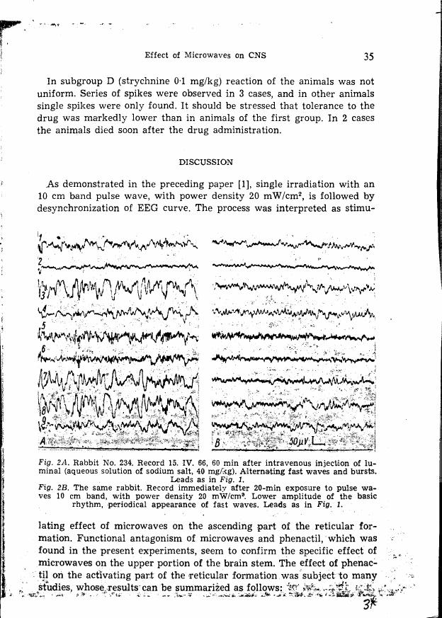 AI-described figure: Electroencephalogram (EEG) recordings from a rabbit before and after microwave exposure, showing changes in wave patterns.